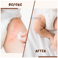 Coco Crush 100% Pure Rash Oil thumbnail