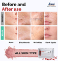 VCare Whitening Peel Off Mask Powder thumbnail