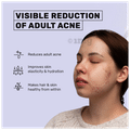 What's Up Wellness Anti-Acne Titagen Marine Collagen Type I & III Black Currant thumbnail