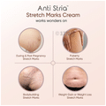 PlusPlus Anti Stria Intensive Stretch Marks Cream thumbnail