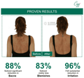 CGG Cosmetics Salicylic Acid Body Spray thumbnail