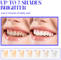 Vtly Teeth Whitening Pen thumbnail