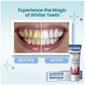 Orasore Whitening Toothpaste (100gm) with Bamboo Toothbrush Free Inside thumbnail