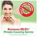 Acnes Purifying Treatment Kit thumbnail