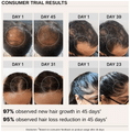 Bare Anatomy Advanced Hair Growth Serum thumbnail