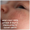 Coco Crush 100% Pure Rash Oil thumbnail