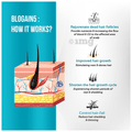 Blogain 5 Minoxidil Topical Solution USP 5% thumbnail