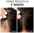 mCaffeine Advanced Hair Growth 20% Caffexil Serum thumbnail