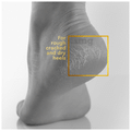 VLCC Clinic Heel Repair Cream thumbnail