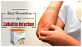Vedangah Anti Fungal Cream (12gm Each) thumbnail
