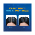 Combo Pack of Scalpe+ Expert Anti Dandruff Shampoo (75ml) & Tata 1mg Biotin Gummies for Healthy and Happy Hair (30) thumbnail