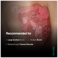 MaxioCel 100% Chitosan Wound Dressing 45x45cm for Burns thumbnail