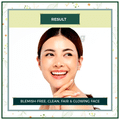 Indus Valley Acne Control Face Pack DIY Combo Beauty Kit thumbnail