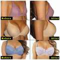 Fasczo Kaya Nikhar For Breast Care Cream thumbnail