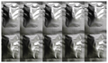 Polyclav 625mg Tablet thumbnail