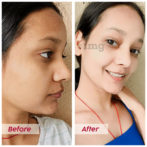 plix glutathione how to use Plix Olena Glowy Skin with 500mg Glutathione & Hyaluronic Acid |  Effervescent Tablet