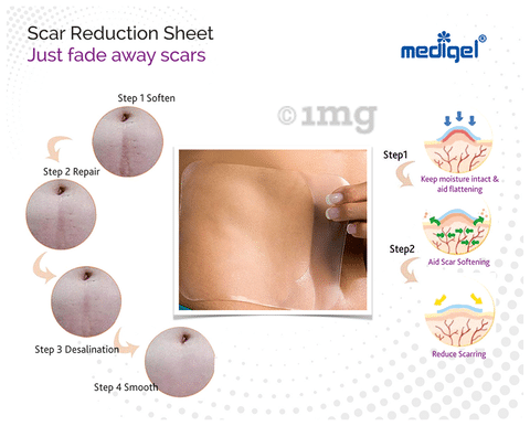 Scar outlet reduction sheets