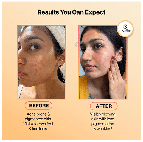 glutathione tablet before and after Setu Skin Radiance Combo Pack of Skin Glow Fizzy Glutathione Effervescent  Tablets (30 Each) & Marine Collagen Powder (210gm)