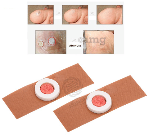 AHC Corn Removal Plaster (6 Each) image