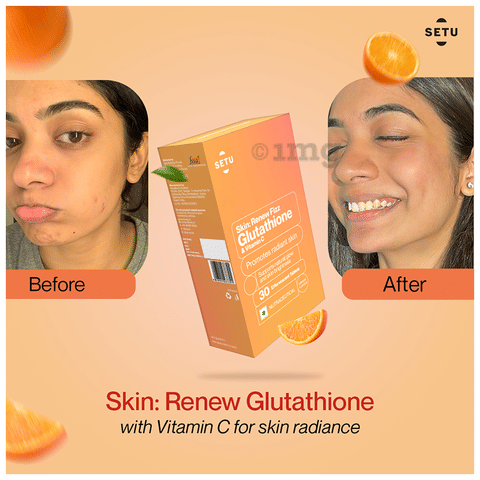 relumins glutathione complex Setu Skin: Renew Fizz Glutathione & Vitamin C Effervescent Tablets (15  Each) & Lean: Lite Tablets (30 Each): Buy combo pack of 2.0 Packs at best  price in India