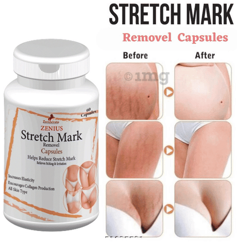 Zenius Stretch Mark Removal Capsule image