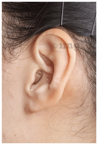 Invisible Hearing Aids Price in India
