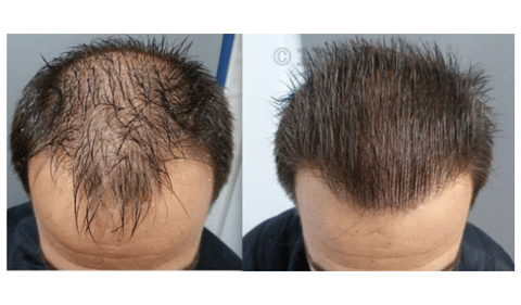 Tinfal Plus Solution image