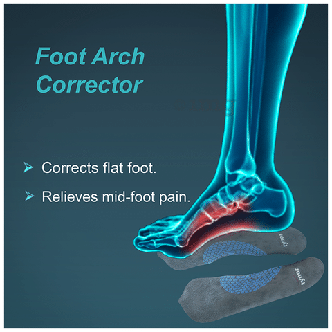 Medial arch store