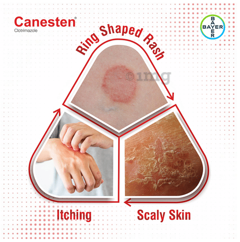 Canesten Topical Solution image Canesten Topical Solution image