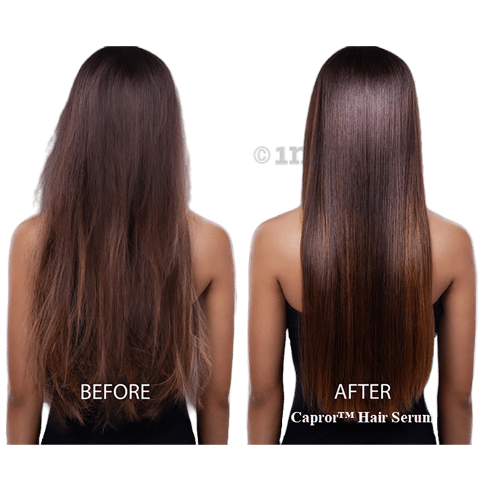 Buy Best Hair Growth Serum in India for Hair Fall Regrowth Women