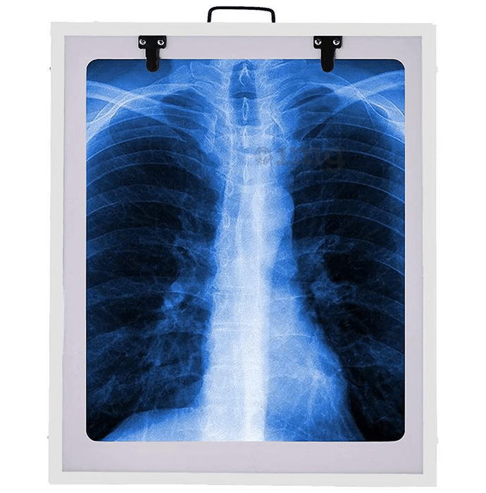 Fidelis X'ray View Box 14inch x 17inch White Single