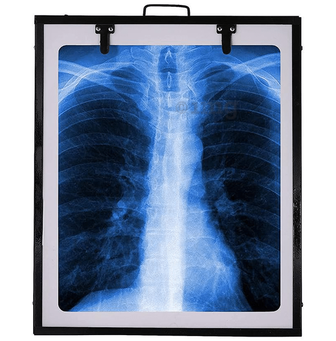 Fidelis X'ray View Box 14inch x 17inch Black Single