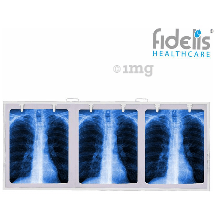 Fidelis X'ray View Box 18inch x 42inch White Triple
