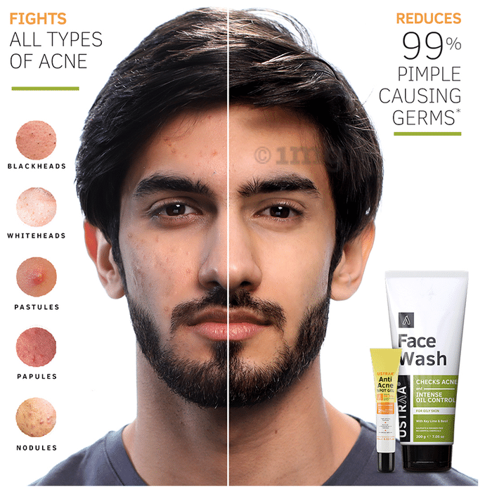 Buy The Shwetambari Combo of Hair Growth Kit (Pack of 4) Online at Best  Prices in India - JioMart.